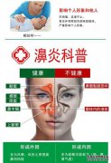 通过鼻子每天发现三次被称为“鼻炎治疗”的自