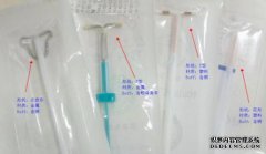 五年前，一个26岁的女人，将上避孕环分为五个部
