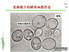 显微镜观察实验酵母的步骤。
