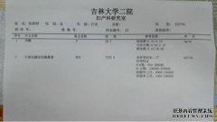 66.8 ngL雌二醇正常吗？