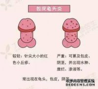 包皮垢清洗干净吗？不要犯错！