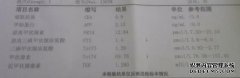 AM和PM的缩写是am，PM慢，英语的缩写是什么？