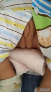 3个月的婴儿生殖器官。只有一个正常的鸡蛋吗？
