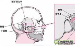 [发生像下巴一样的脱位？]