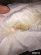 宫颈麻痹怎么发生？