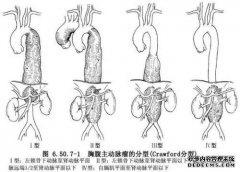 医生不敢因为股骨颈骨折，原来是腹主动脉瘤