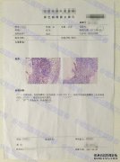 上周，在一名妇女出现高危型HPV阳性后，一周后